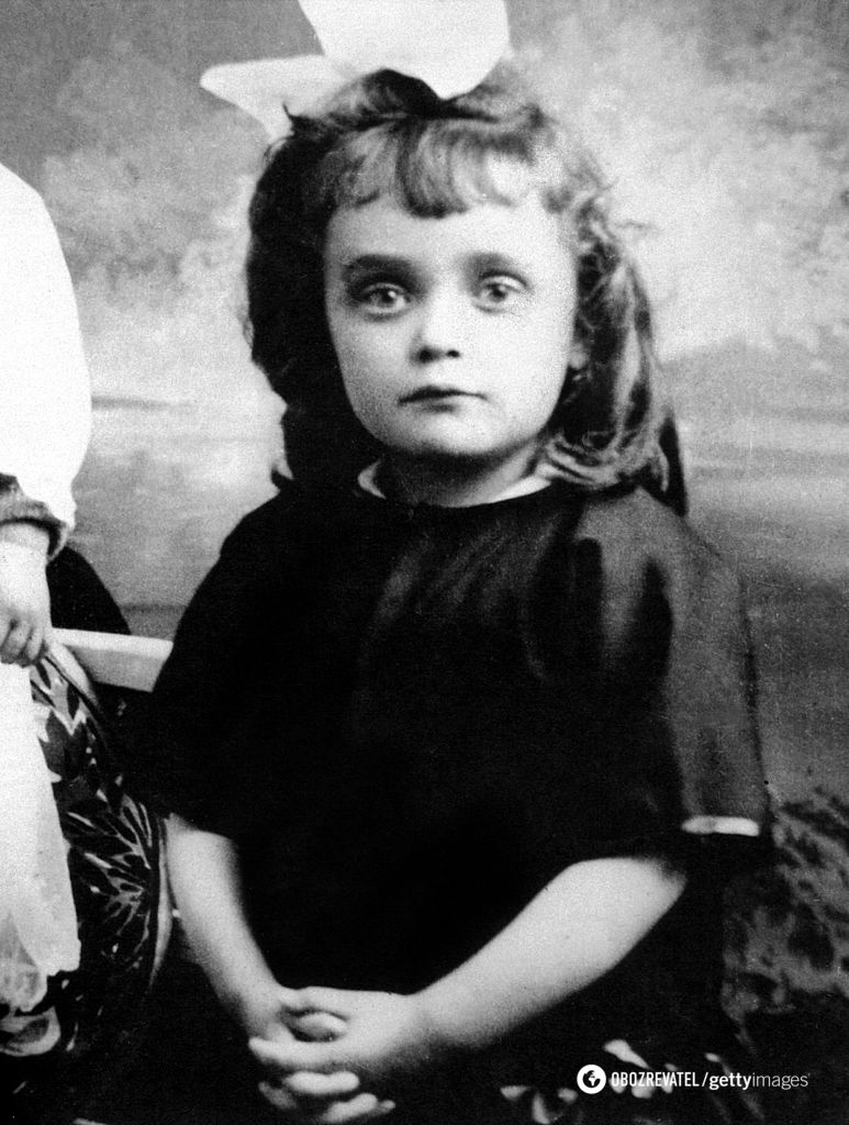 В детстве у Эдит Пиаф была катаракта.