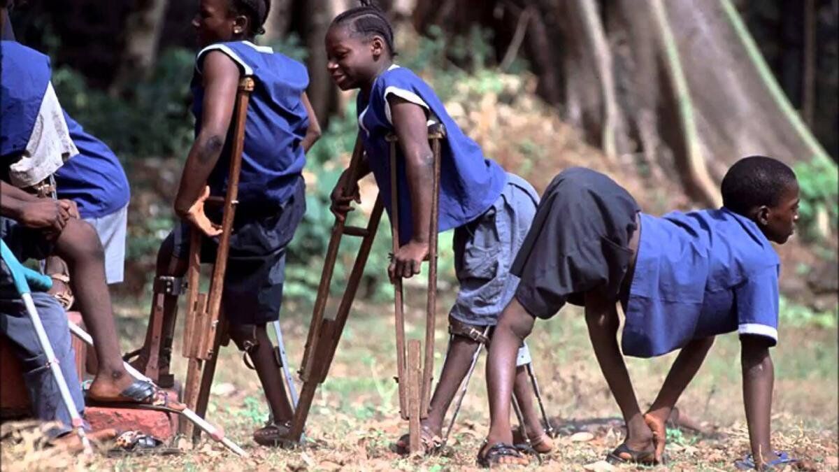 Дети, переболевшие полиомиелитом в Африке