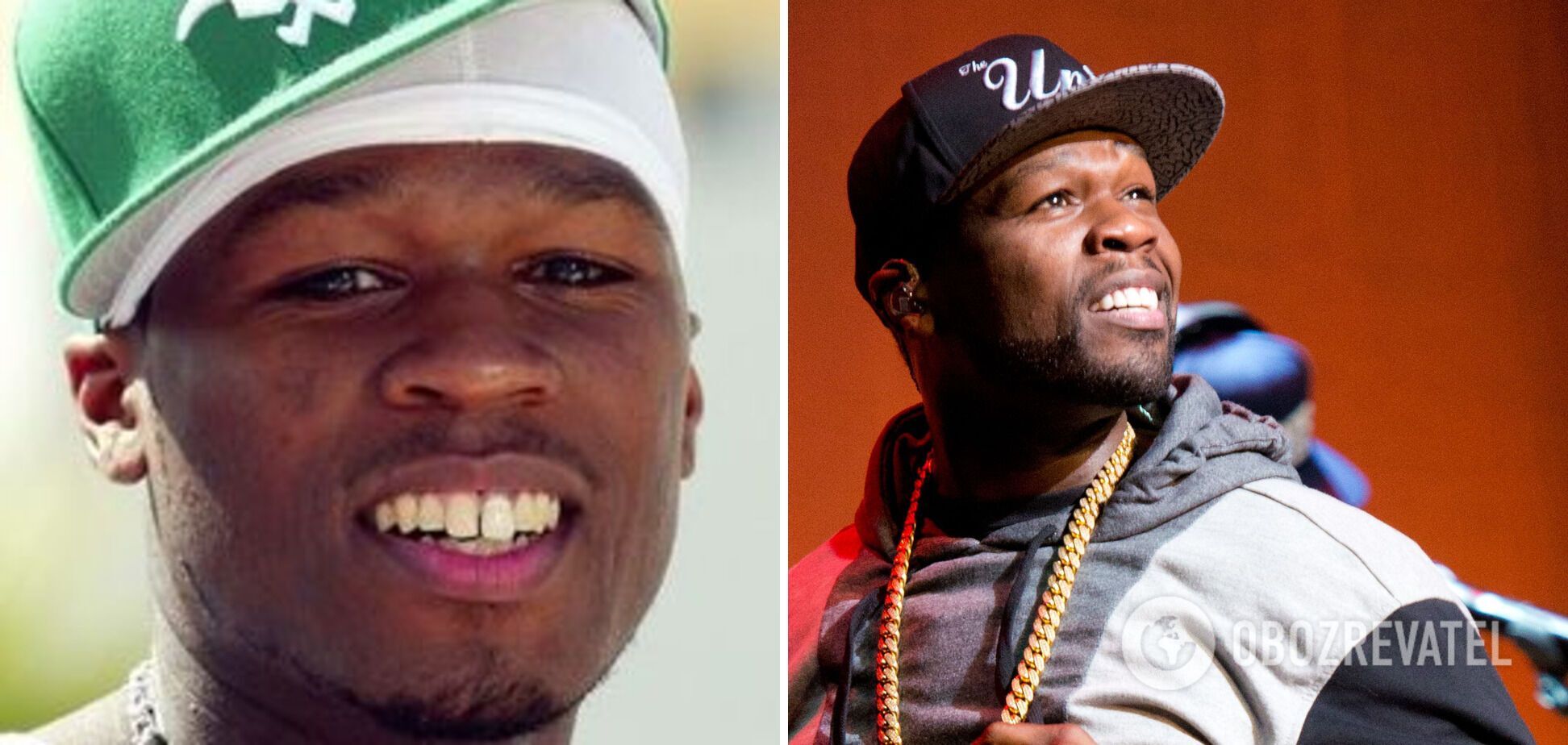 50 Cent має вставні зуби