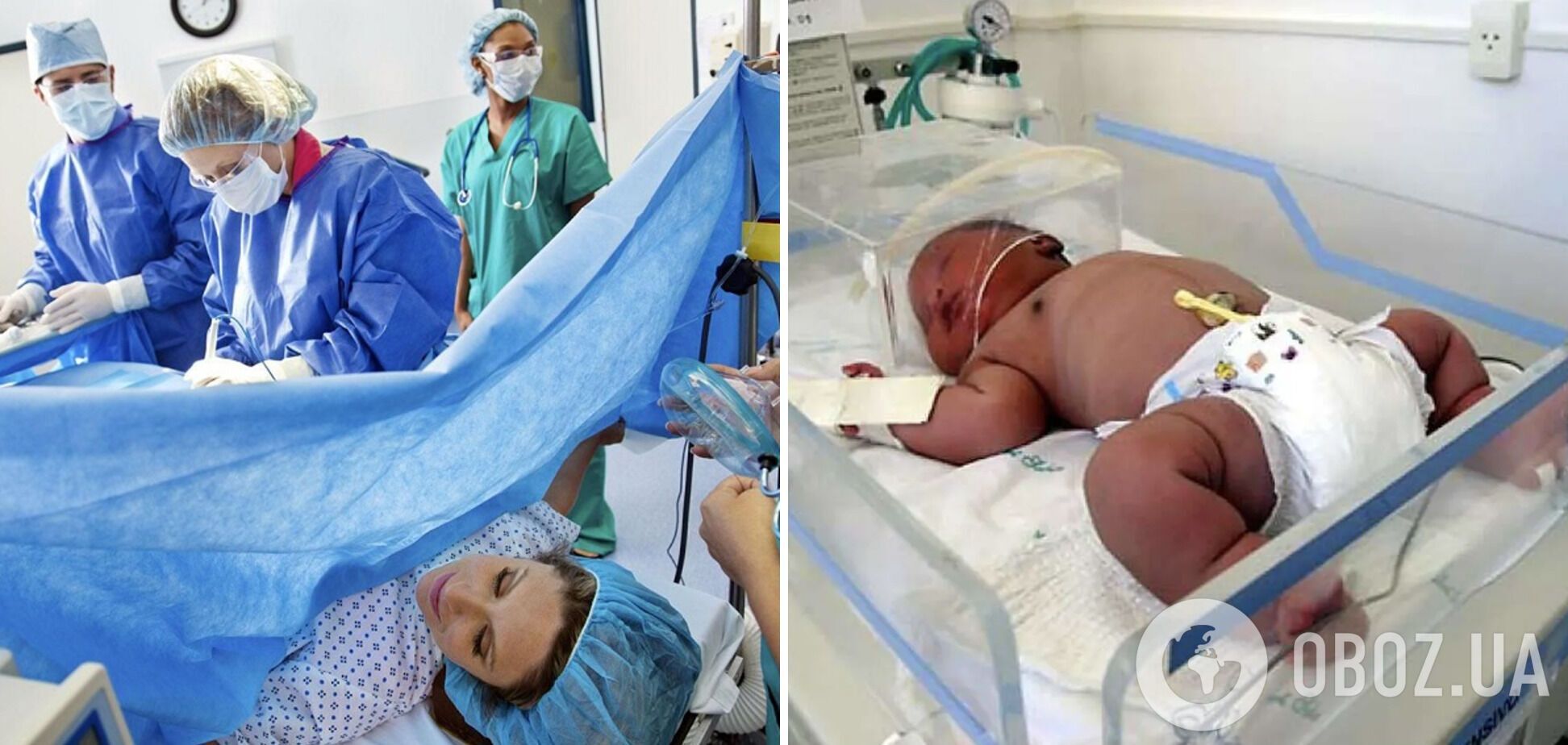 Мамочка родила богатыря с помощью кесарево