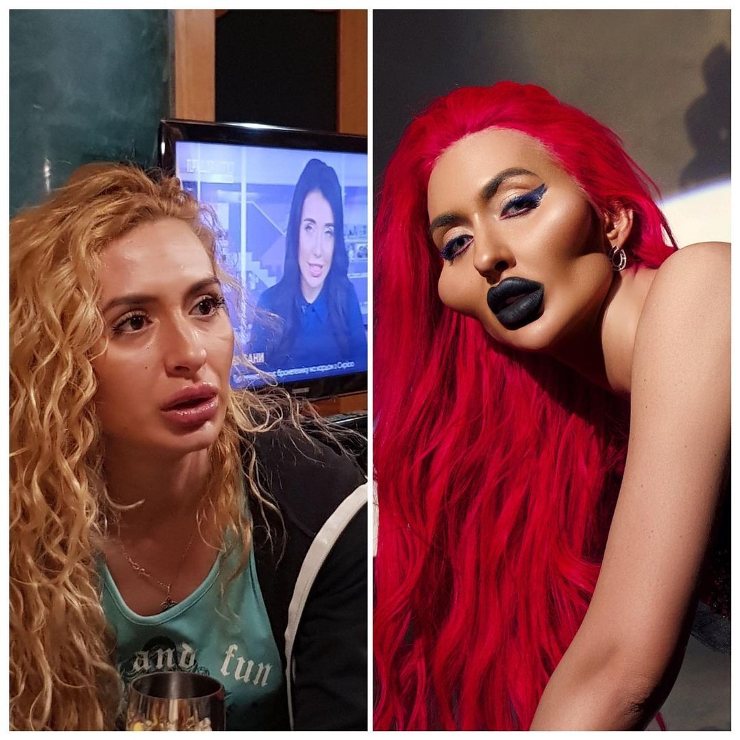 Анастасия Покрещук показала себя до пластики скул.