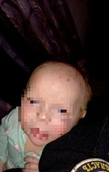 На Винниччине пьяный отец избил младенца: ребенок попал в больницу с сотрясением мозга. Фото