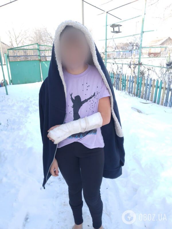 Лиза вторую неделю дома со сломанной рукой