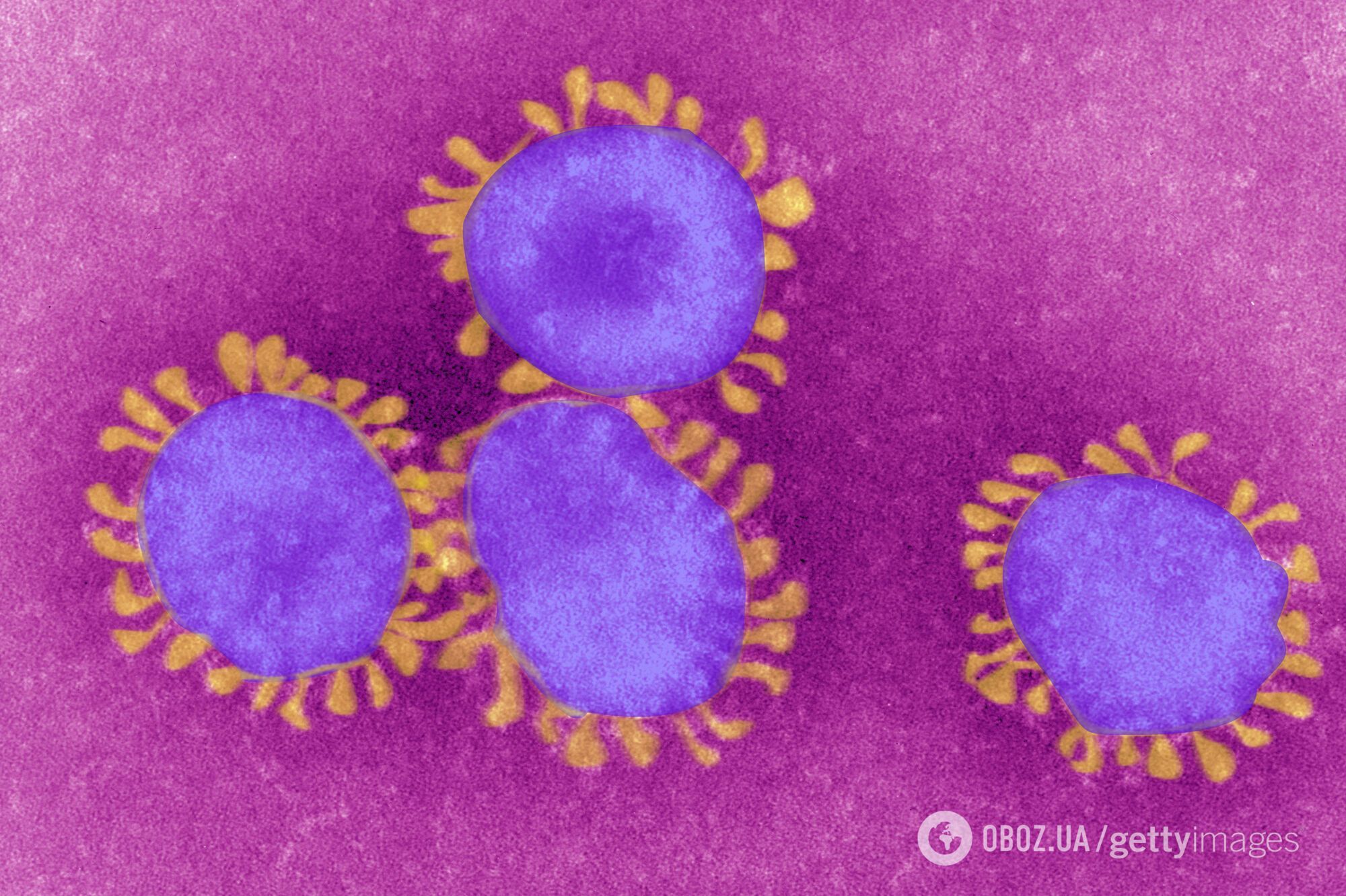 Коронавирус может стать вечным "гриппом".