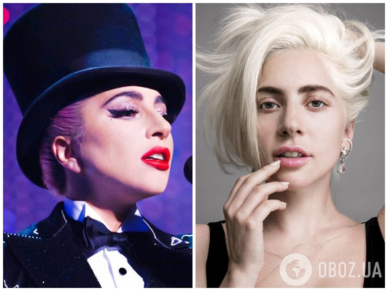 Леді Гага завжди вирізнялася грубими рисами обличчя