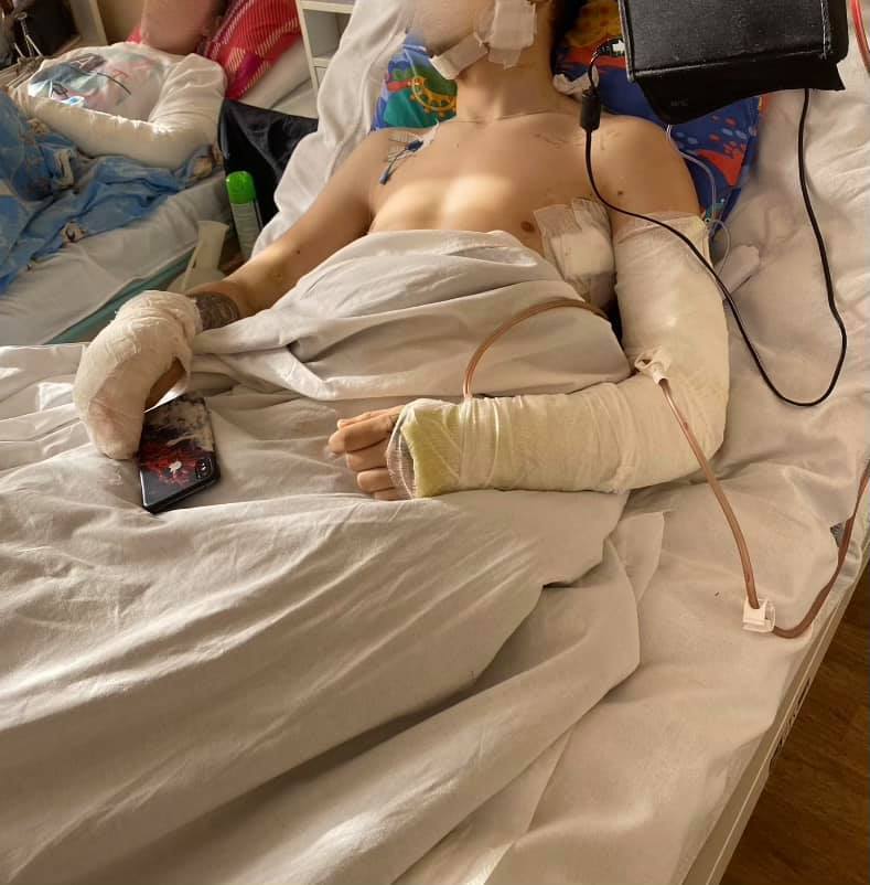 Раненые в госпитале, много с ампутациями: нужна помощь