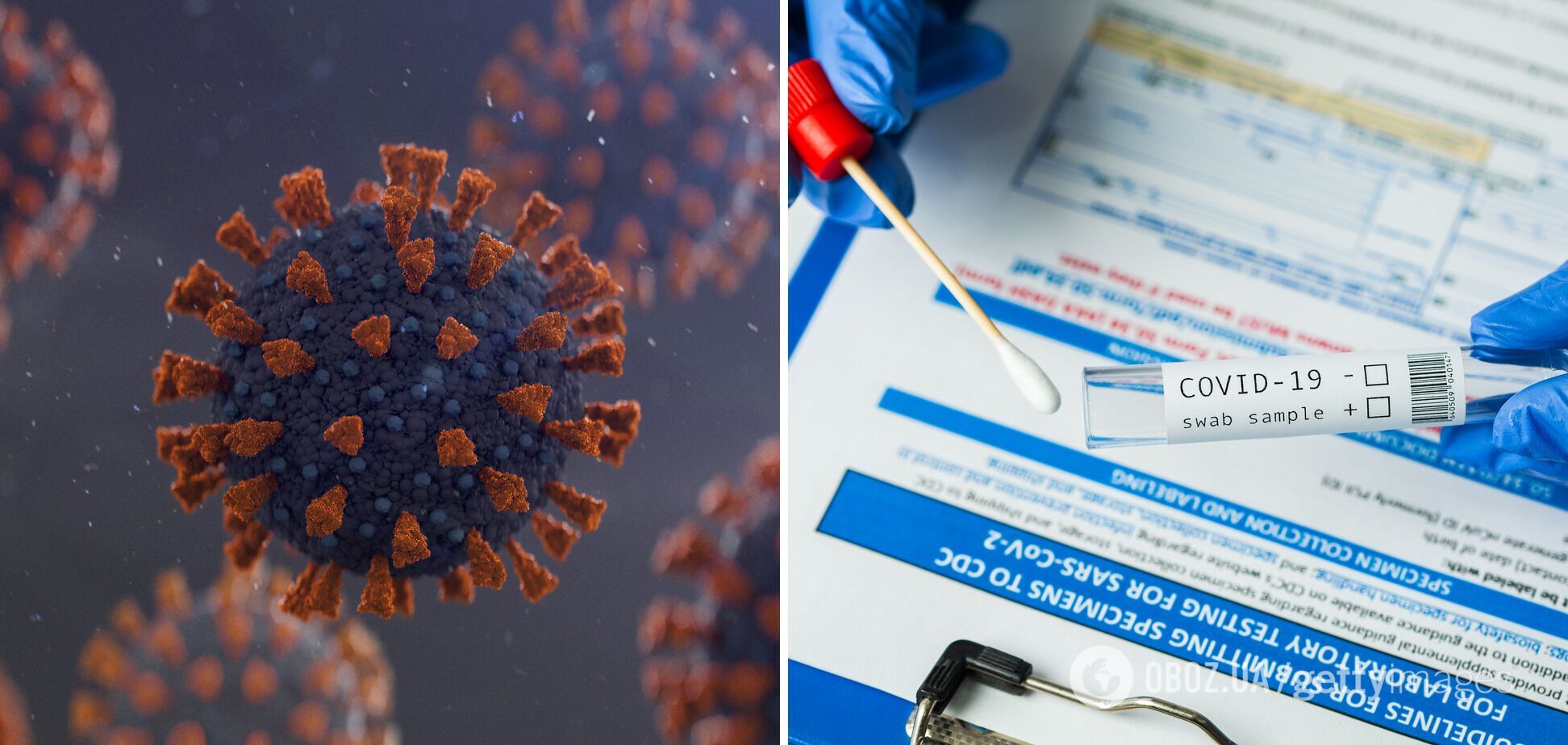 Во Франции выявили новый штамм коронавируса, которого не видят тесты