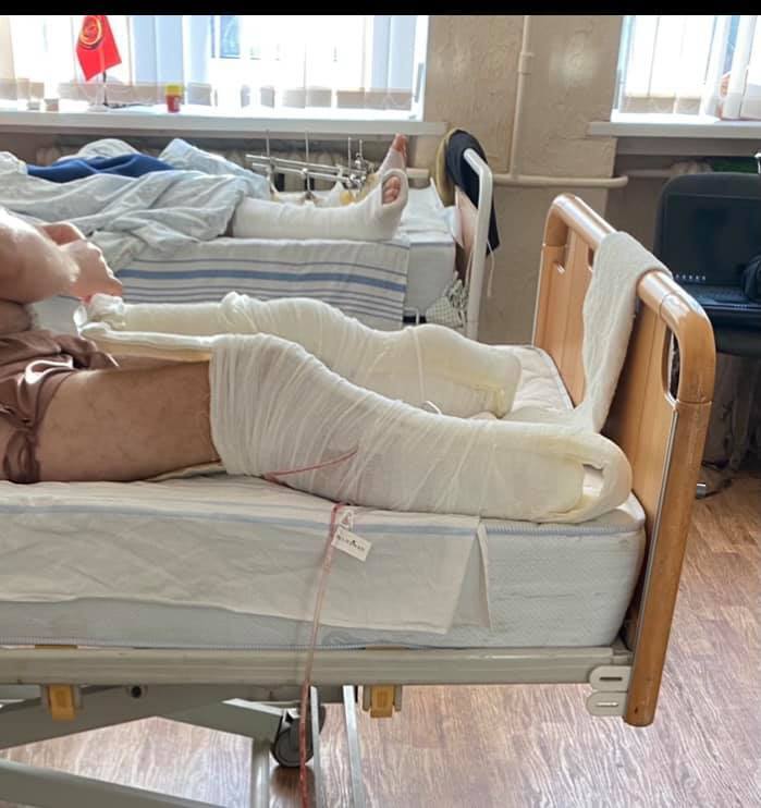 Низка швидких пронеслася Києвом: пораненим героям Донбасу потрібна допомога