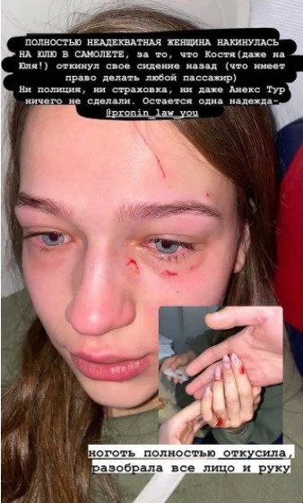 Юлия, которая пострадала во время конфликта в самолете