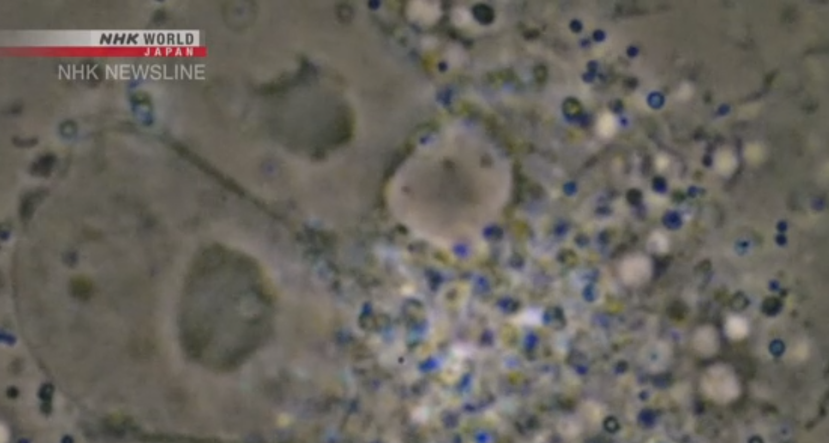Ученые показали, как COVID-19 убивает клетки в организме. Фото