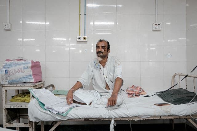 Індію вразив "чорний грибок": історії пацієнтів, які після COVID-19 втратили зір. Фото