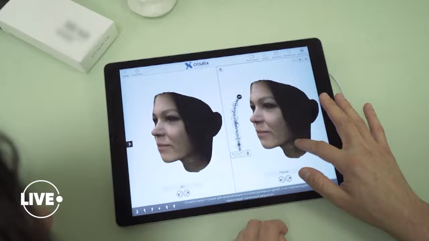 У клініці зробили 3D-модель обличчя жінки