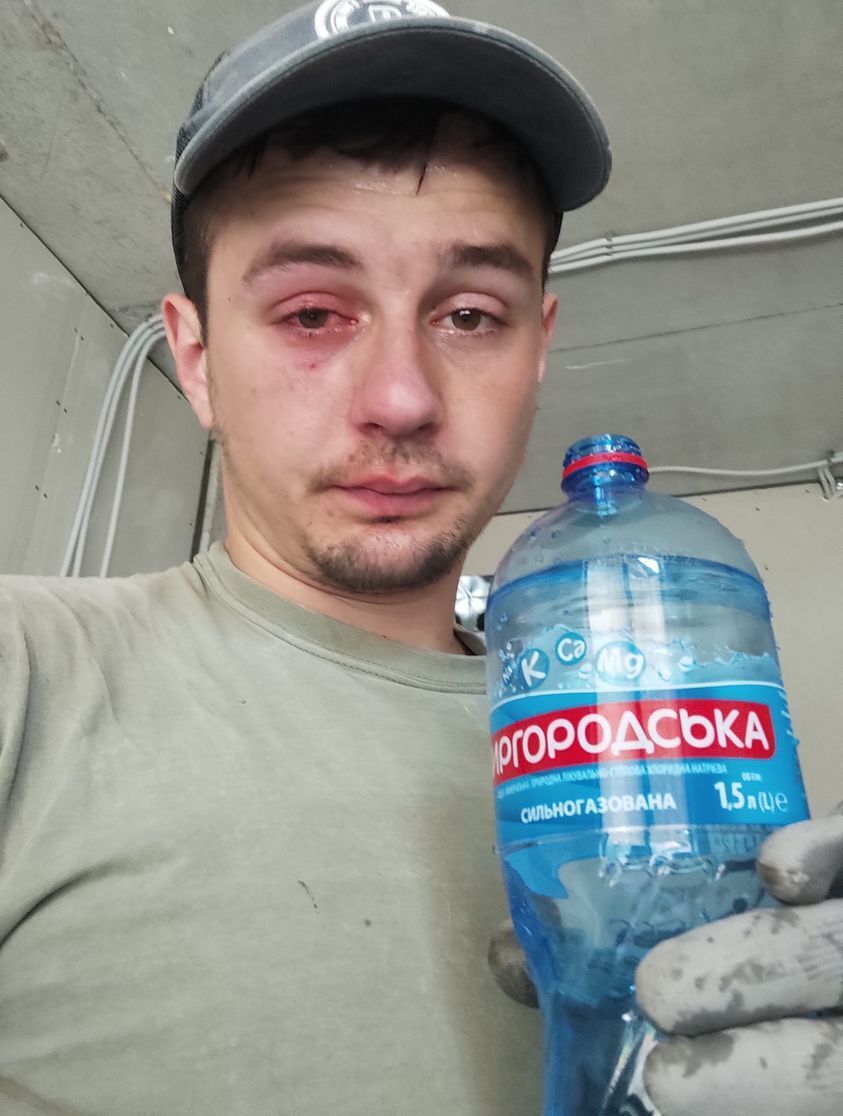 Андрій Зубко пошкодив око