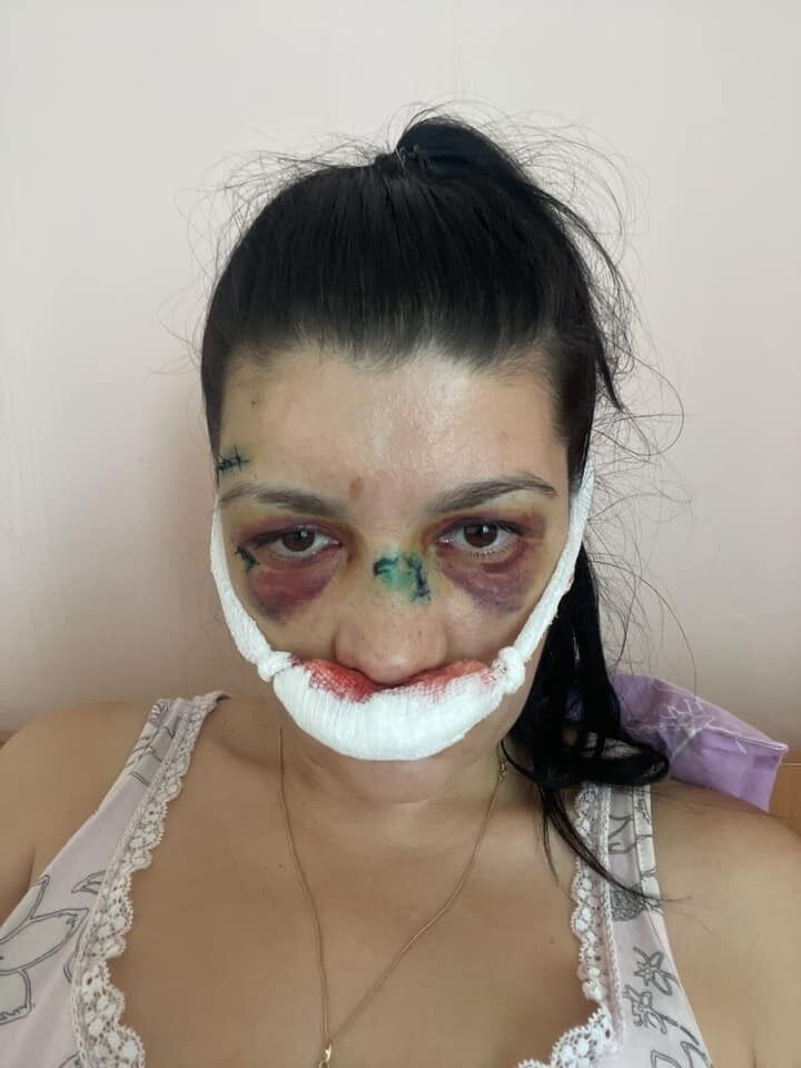 Она заявила, что уже чувствует себя лучше