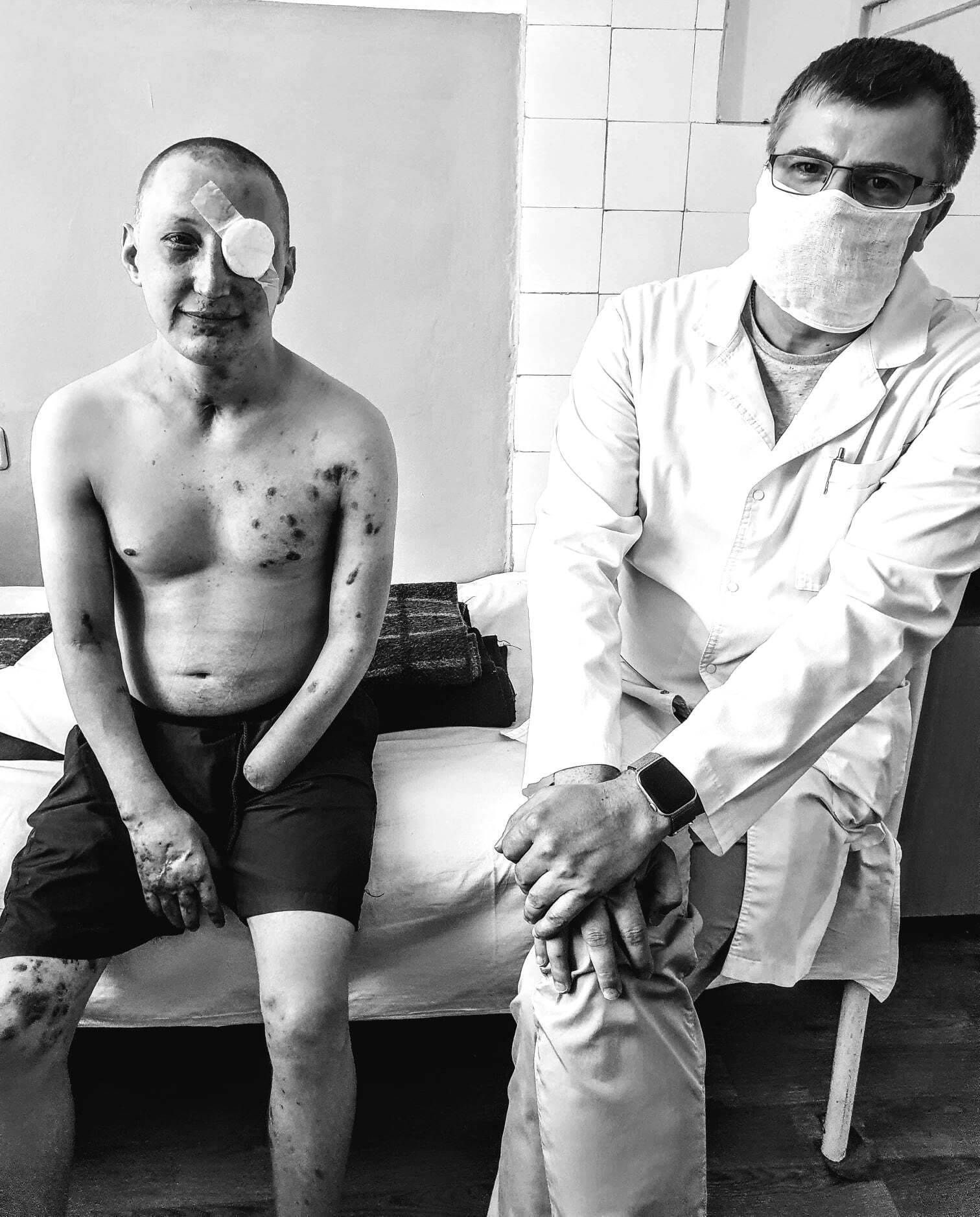 Операцію на вцілілому після вибуху оці Віталію зробили в Одеському військовому госпіталі
