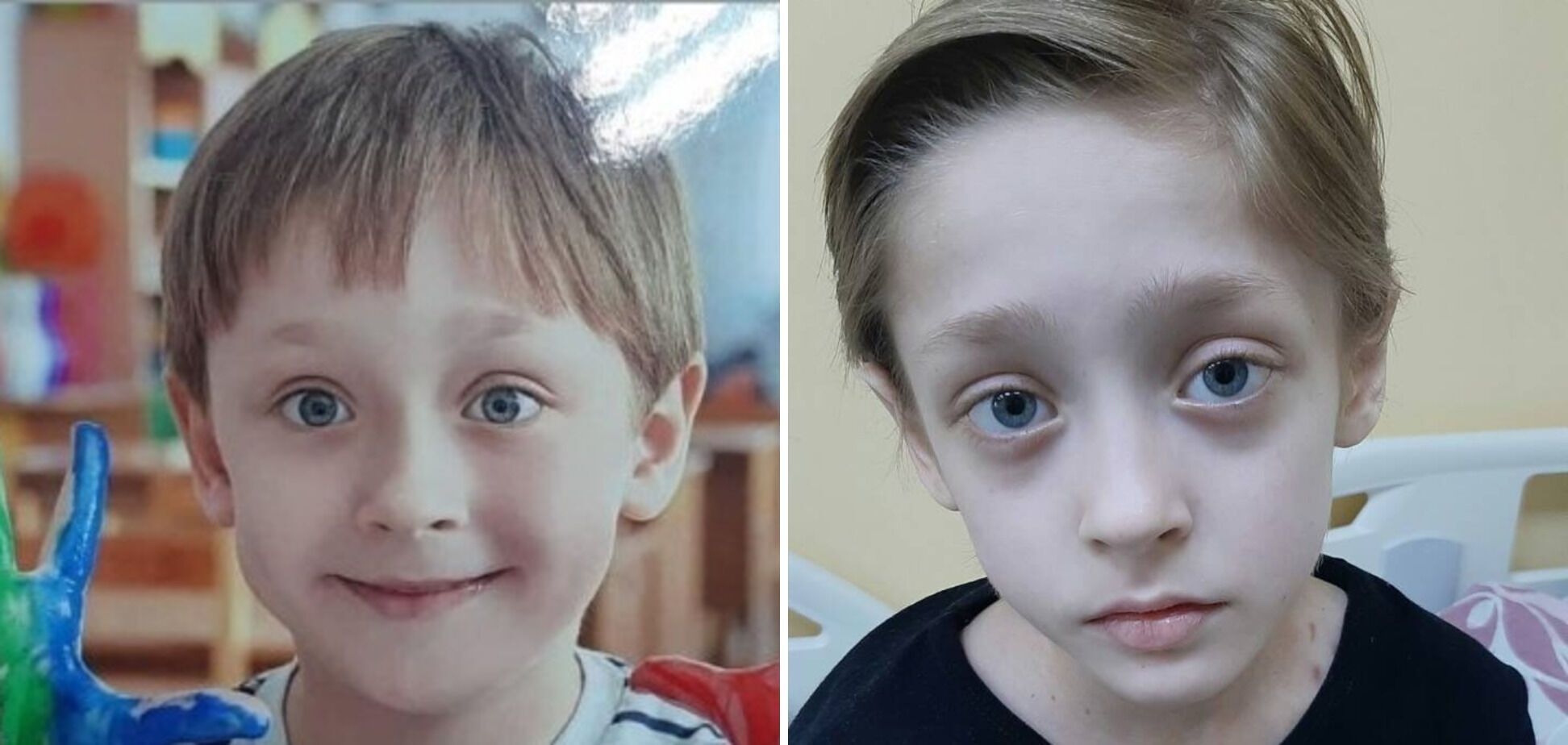 "Не можу втратити цю дитину": 9-річний Єгор із Києва бореться з онкозахворюванням