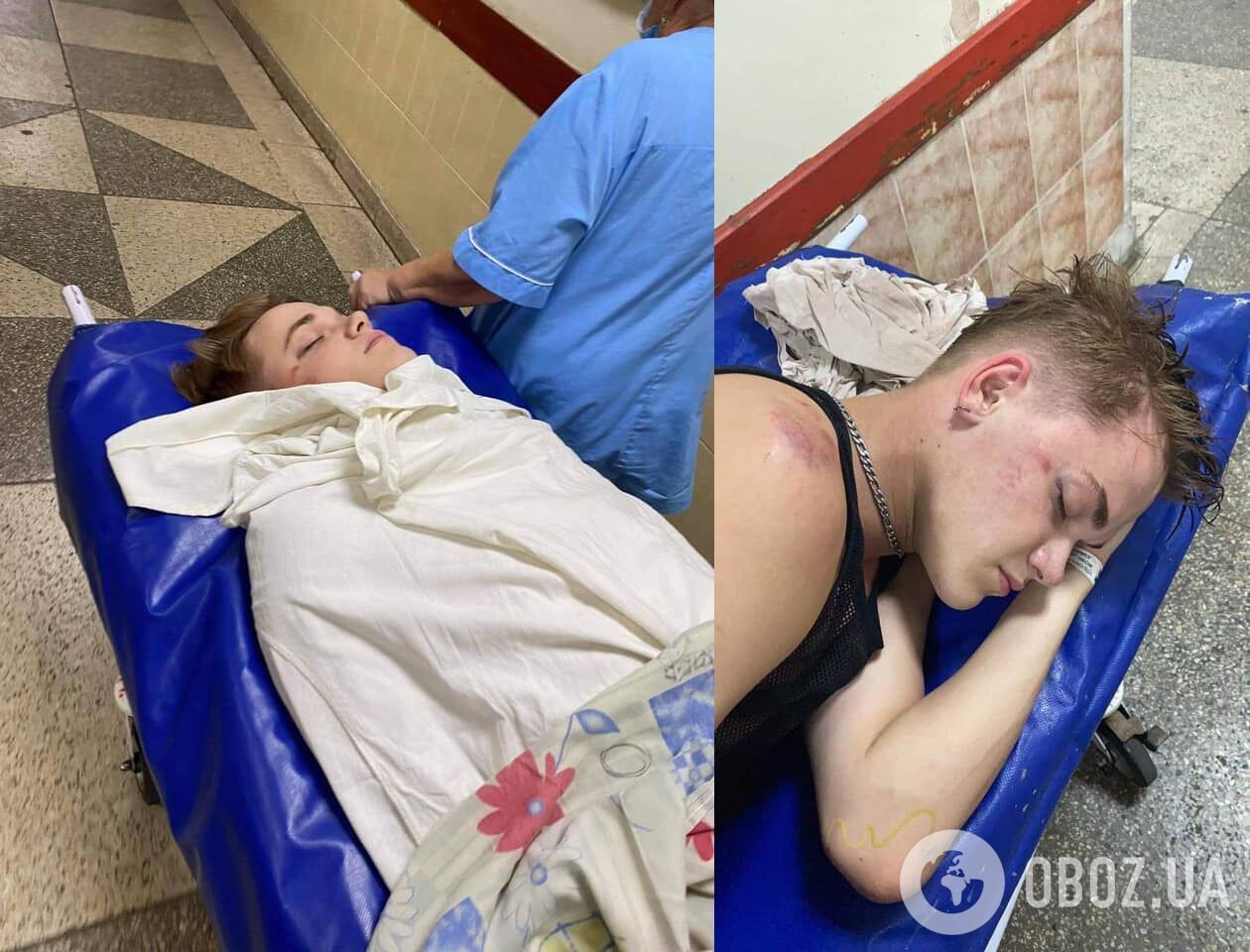Избитого танцора Дорофеевой выписали из больницы после 15-дневной комы. Фото