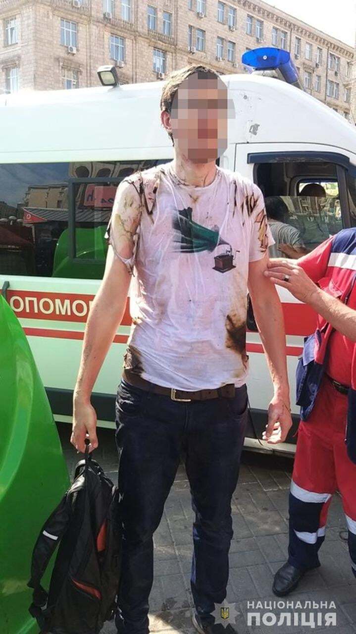 Чоловік підпалив себе під час параду в Києві