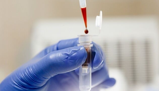 Дельта-штам коронавірусу поширюється в Україні