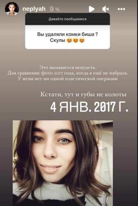 Анна Неплях до того, як набрала вагу та збільшила губи