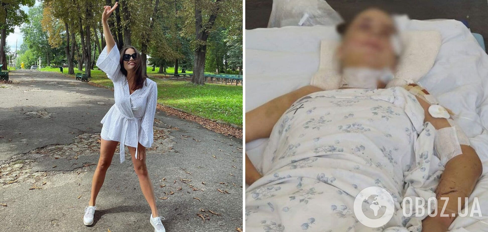 Юлія Ільницька до аварії та після.