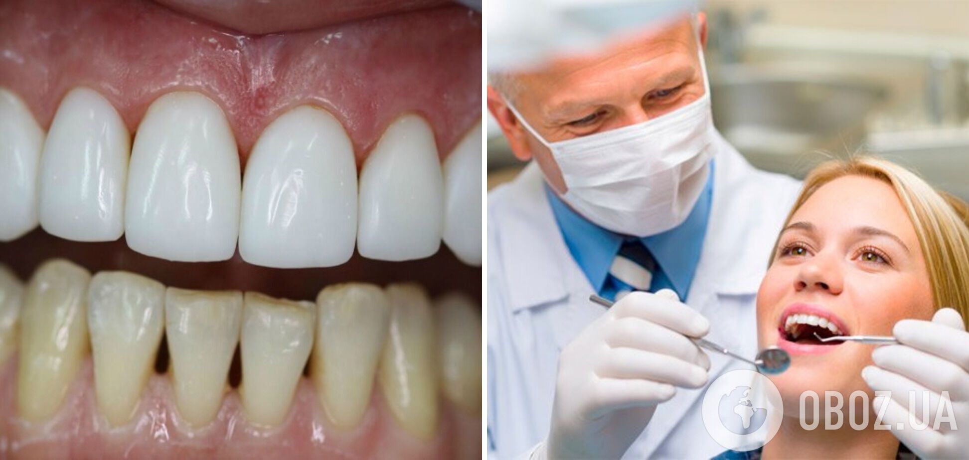 Топ-9 маловідомих фактів про зуби