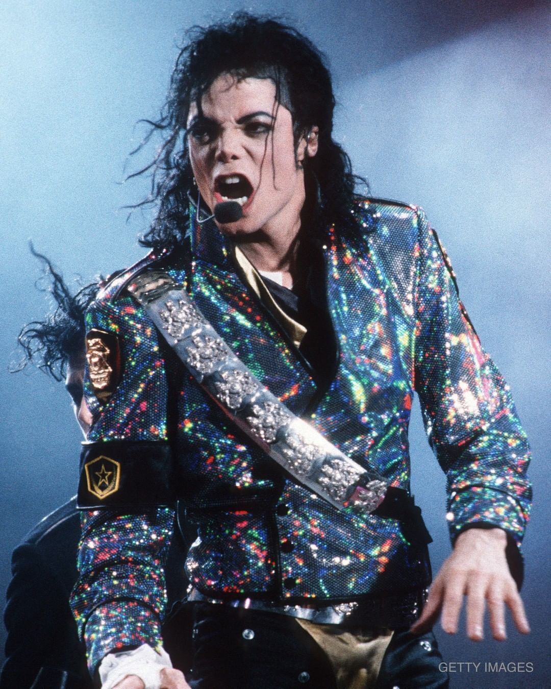 Майкл Джексон палахкотів як факел. Чому насправді співак облисів і робив багато пластичних операцій