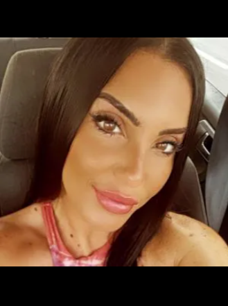 Жертва пластичної хірургії Сара Гомес