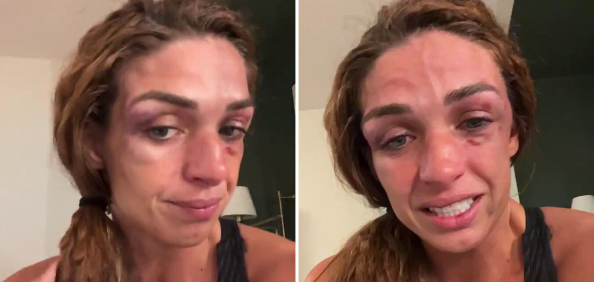 Девушка-боец показала свое лицо после 150 пропущенных ударов. Видео