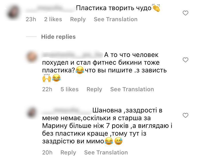 С лишним весом и короткими волосами: участница "Холостяка" показала, как выглядела до пластики. Видео