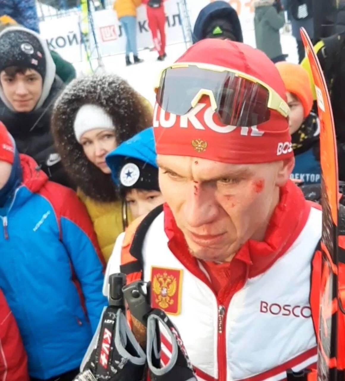 До потери сознания и крови: лучшие лыжники России столкнулись во время гонки Кубка РФ. Видео