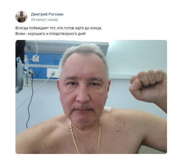 Рогозин показал первое фото после ранения в Донецке, но есть "нюанс"