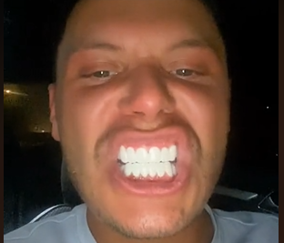 У Оуэна Макконнела теперь неправильный прикус.