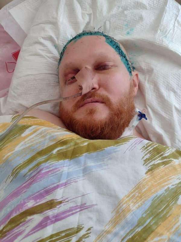 Дмитро Мироненко у лікарні після важкої операції