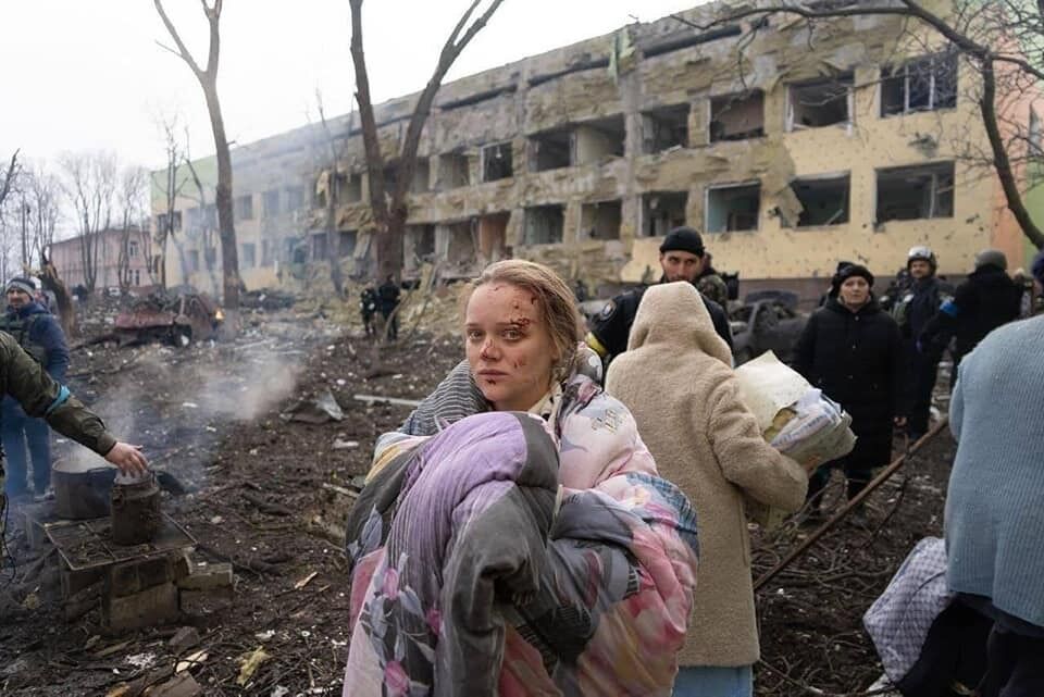 Кличко – про бомбардування пологового будинку: подивіться на ці фотографії. Коли Путін не вбиває дітей, він вбиває їхніх батьків