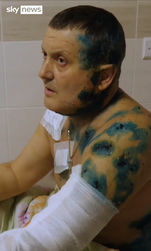 Олександр Дьяченко отримав поранення внаслідок сильного вибуху