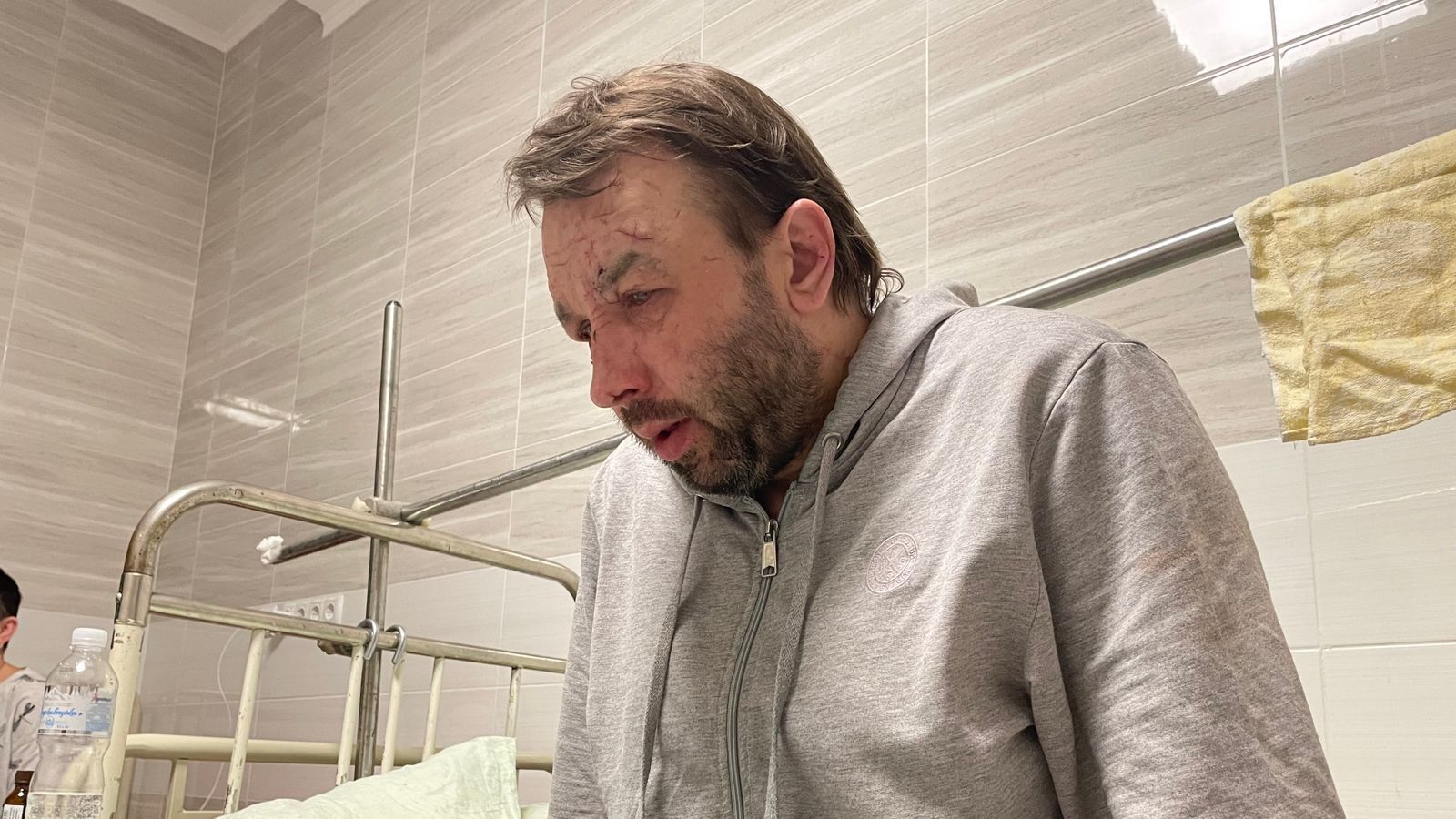 Віталій Виговцев практично втратив зір через вибухи 18 березня