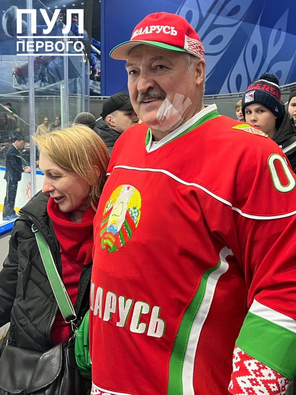 Лукашенко с пластырем