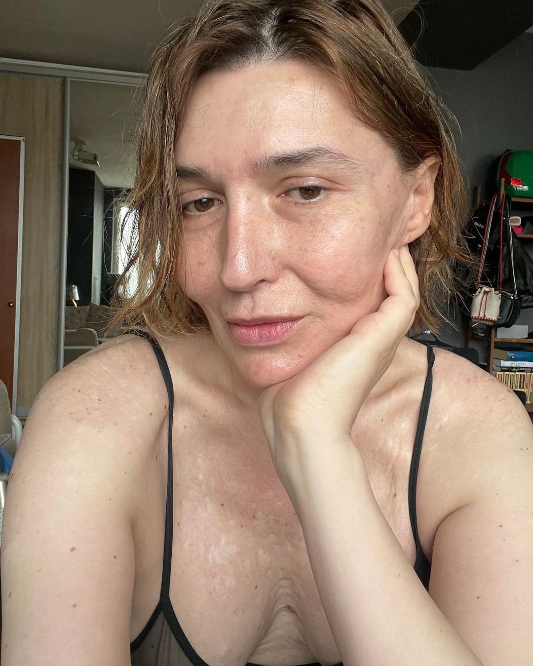 Россиянка-трансгендер сравнила свои прыщи с Мариуполем и спровоцировала громкий скандал 2