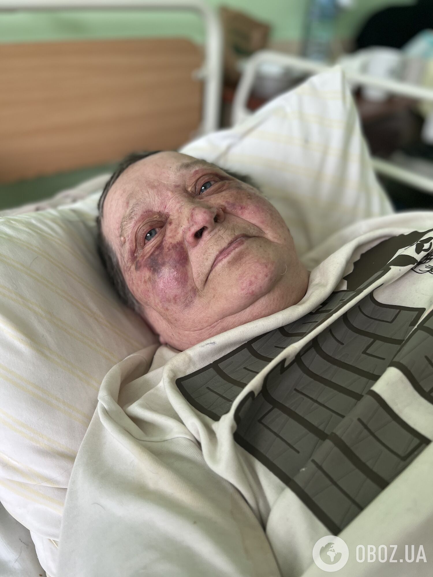 Избили до полусмерти: львовские медики спасают жительницу Херсона 2