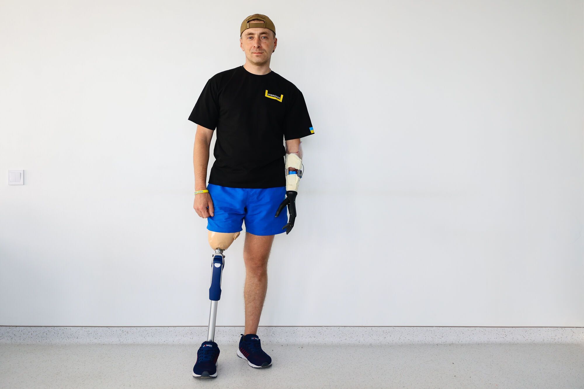 Захисник України, який втратив руку і ногу під Ізюмом, отримав біонічний протез. Фото 