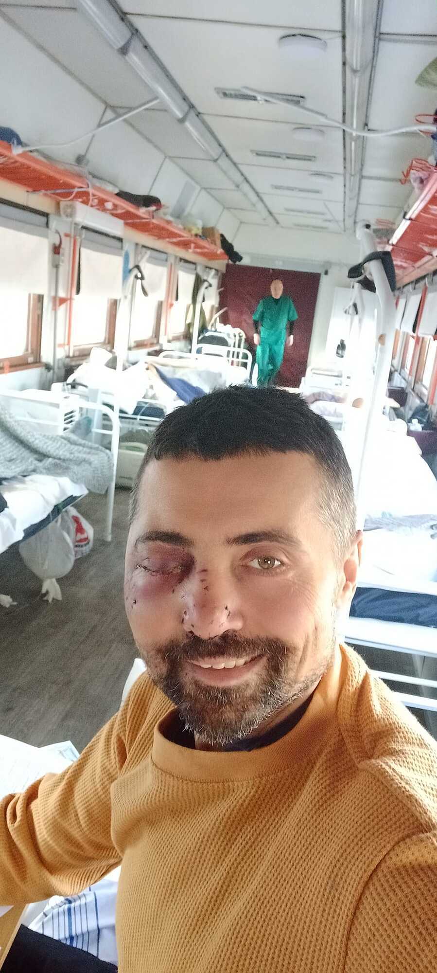 Актор-воїн Лінартович опублікував своє перше фото після важкого поранення під Бахмутом: спроби усміхнутися