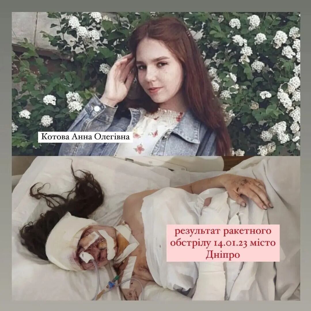 19-летняя девушка получила страшные травмы