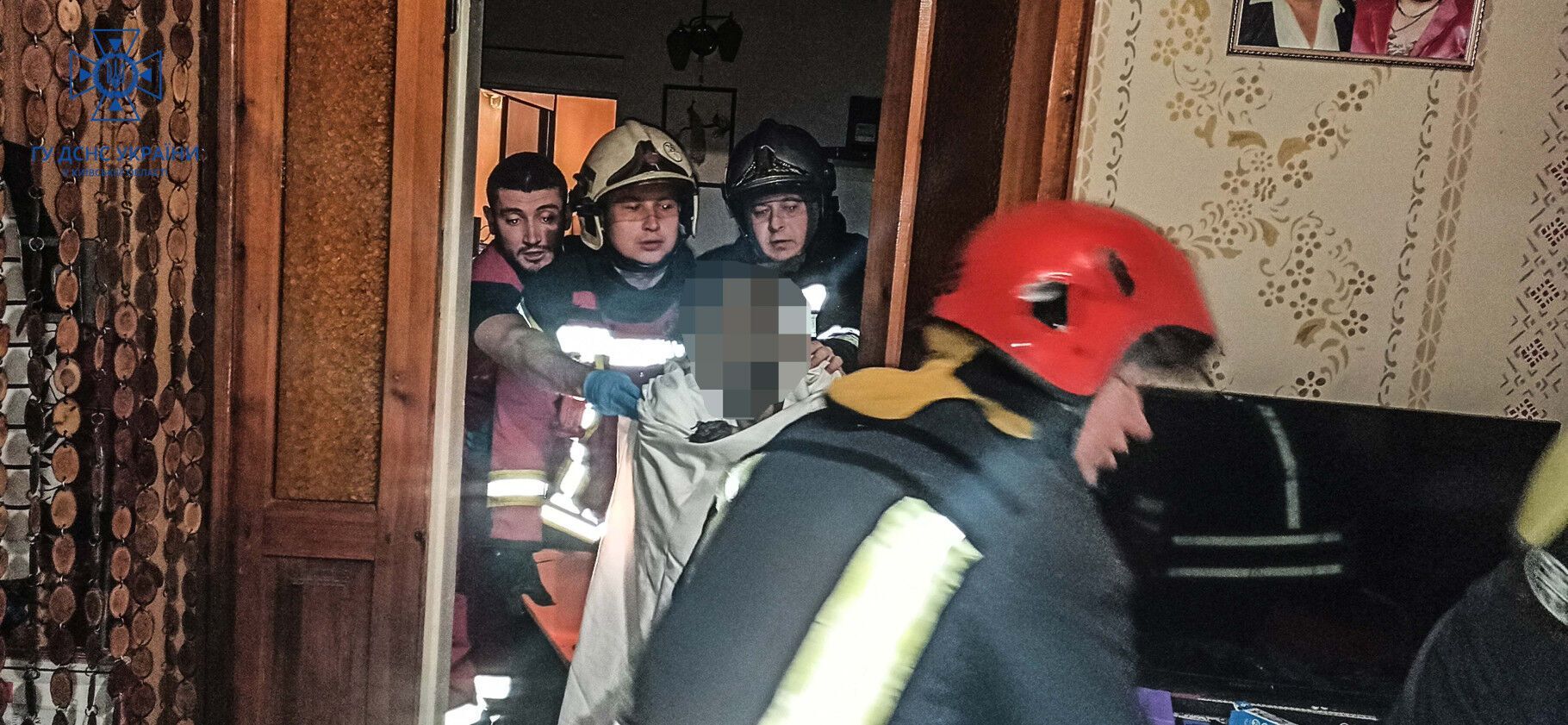 На Київщині пенсіонер через ревнощі облив співмешканку бензином та підпалив. Фото та відео