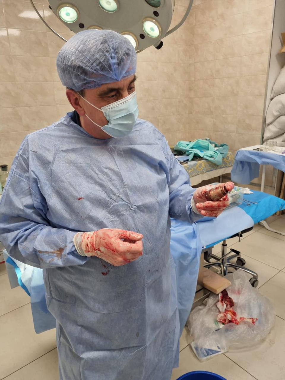 Українські хірурги провели унікальну операцію і дістали  з тіла військовослужбовця гранату ВОГ, що не розірвалася. Фото