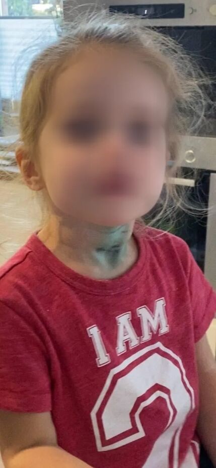 Поліція почала розслідування за фактом побиття дитини в дитячому садочку Києва. Фото