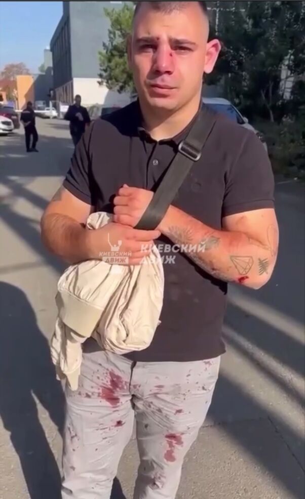 Нардепов Дмитрука и Куницкого обвинили в избиении мужчины в Киеве: известны подробности. Видео