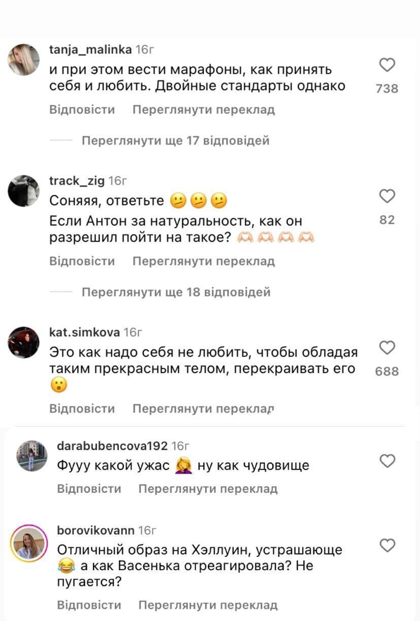 Скандальна блогерка Софія Стужук, яка публічно відреклася від України, налякала "обличчям Франкенштейна": росіяни назвали її "своєю"