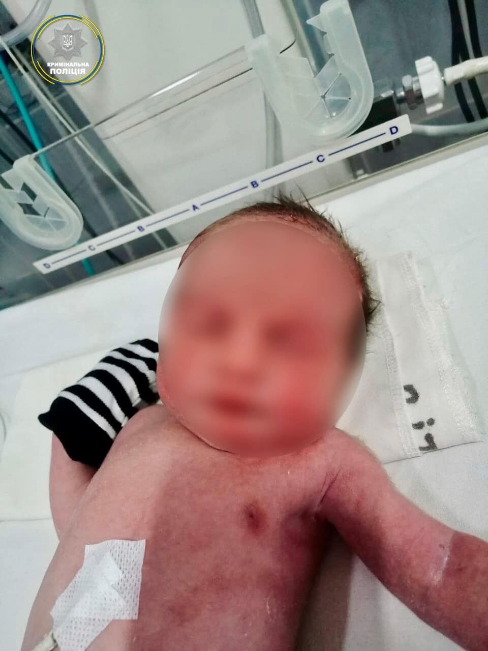 Має ще чотирьох дітей: поліцейські встановили матір, яка викинула немовля на смітник на Полтавщині 