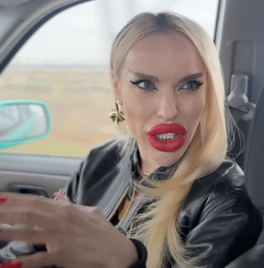 "Королева ДНР" Алина Андриевская объяснила, почему у нее такие большие губы. Видео